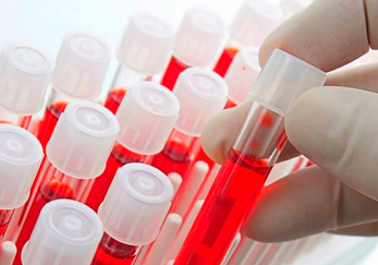 В нашей лаборатории доступно новое исследование – тест на определение группы крови